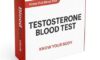 Low Testosterone Blood Test: What to Expect in Watford